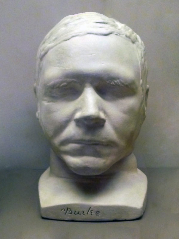 Die Totenmaske des Mörders William Burke (Surgeons’ Hall Museum, Edinburgh)